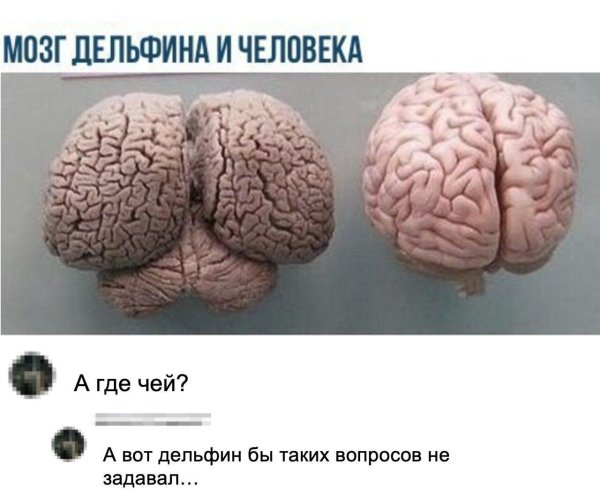 Мозг женщины и мужчины