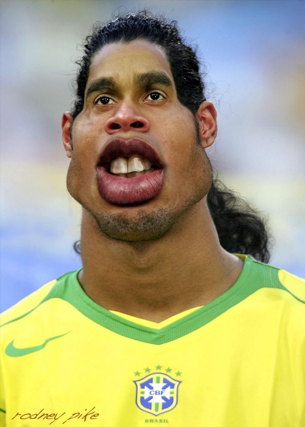 роналдиньо зубы