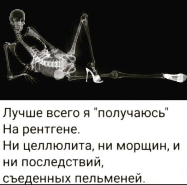 рентген девушки