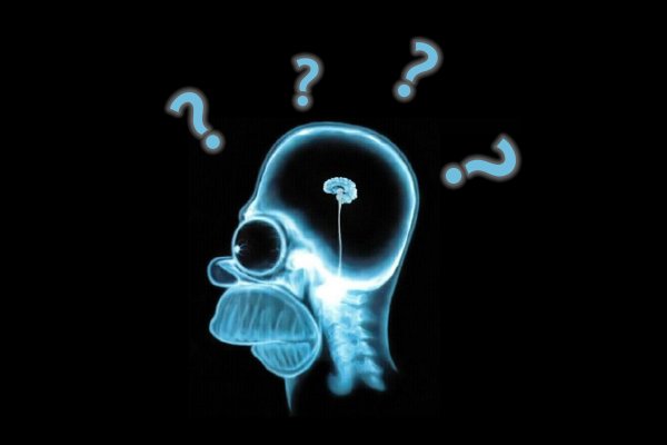 мозг рентген