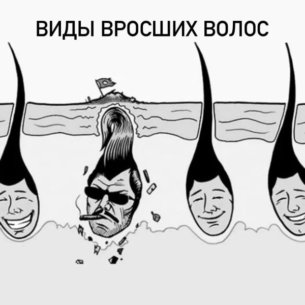 вросшие волоски