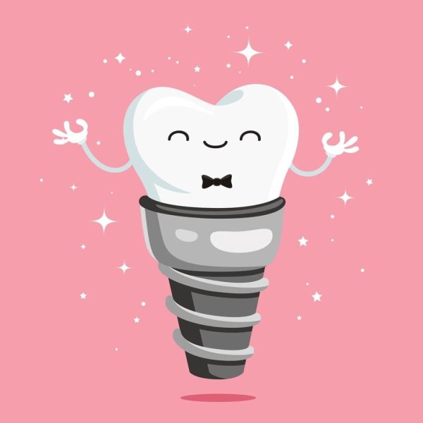 tooth implant